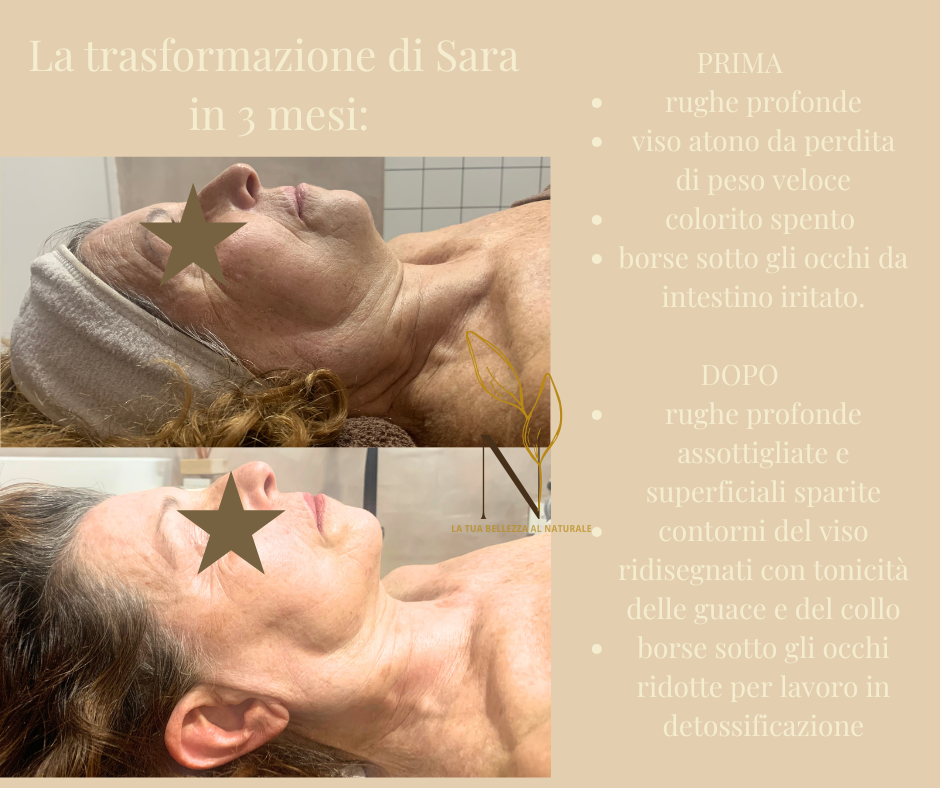Viso stanco e pelle spenta: cause e soluzioni naturali